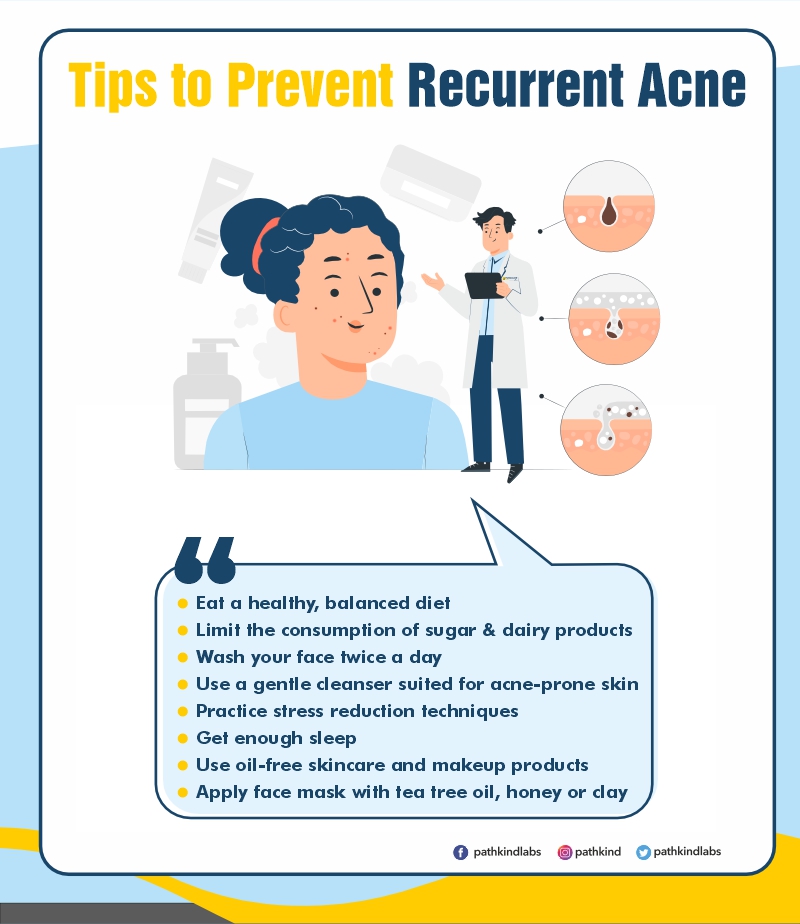 tips to prevent recurrent Acne